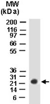 PAB0329 - BAG2