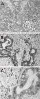 PAB0330 - BAG3