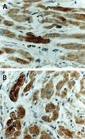PAB0333 - Bcl-2-like 7