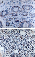PAB0333 - Bcl-2-like 7
