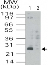 PAB0334 - TMED4 / ERS25