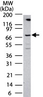PAB0337 - EIF2AK2 / PKR