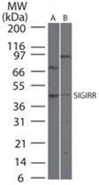 PAB0342 - SIGIRR / TIR8