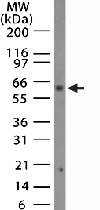PAB0344 - SENP2