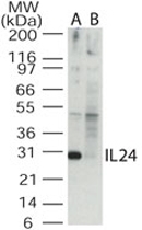 PAB0345 - Interleukin-24 / IL24