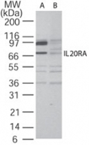 PAB0346 - IL20RA