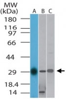 PAB0355 - TLX1