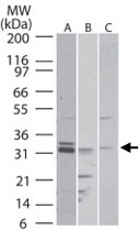 PAB0358 - Nogo 66 receptor