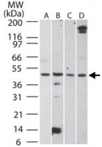 PAB0359 - Aurora kinase A
