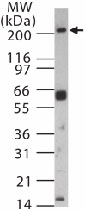 PAB0362 - DICER1