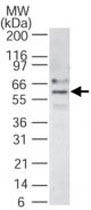 PAB0364 - Interleukin-21 receptor / IL21R
