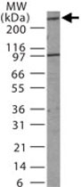 PAB0366 - MDC1