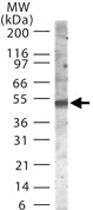 PAB0368 - SMAD6