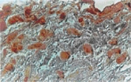 PAB0369 - NIFK