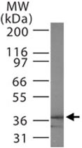 PAB0370 - MAPRE3