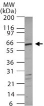 PAB0371 - Adapter protein CIKS