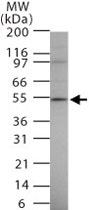 PAB0373 - STK4