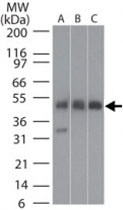 PAB0379 - TUBB2A