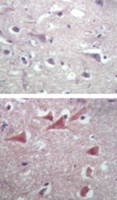 PAB0379 - TUBB2A