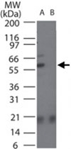 PAB0381 - SMAD2