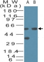 PAB0382 - VDAC2