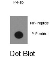 PAB0396 - ABL1