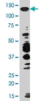 PAB0396 - ABL1