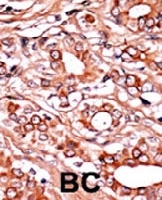 PAB0396 - ABL1