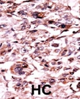 PAB0397 - ABL1