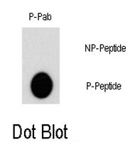 PAB0404 - AKT2 / PKB beta