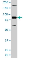 PAB0408 - Amyloid beta A4 protein / APP
