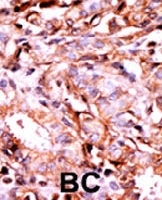 PAB0414 - BACE1