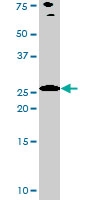 PAB0415 - Bcl-2-like 8