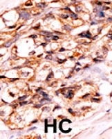 PAB0415 - Bcl-2-like 8