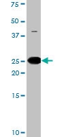 PAB0416 - Bcl-2-like 8