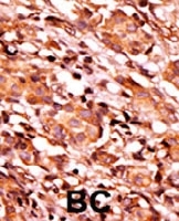 PAB0416 - Bcl-2-like 8