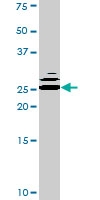 PAB0417 - Bcl-2-like 8