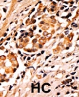 PAB0417 - Bcl-2-like 8