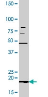 PAB0418 - Bcl-2-like 8