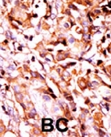 PAB0418 - Bcl-2-like 8