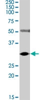 PAB0419 - BID