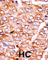 PAB0419 - BID