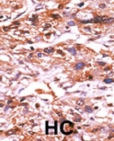 PAB0425 - CDC25A