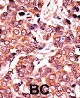 PAB0427 - CDC25A