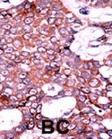 PAB0429 - CDC25A