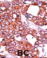 PAB0430 - CDC25A