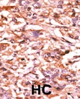PAB0432 - CDC25B