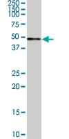 PAB0435 - CDC6