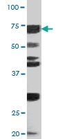 PAB0435 - CDC6