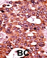 PAB0435 - CDC6